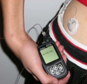 Insulin pump typically used by diabetes mellitus patients for administering insulin.  