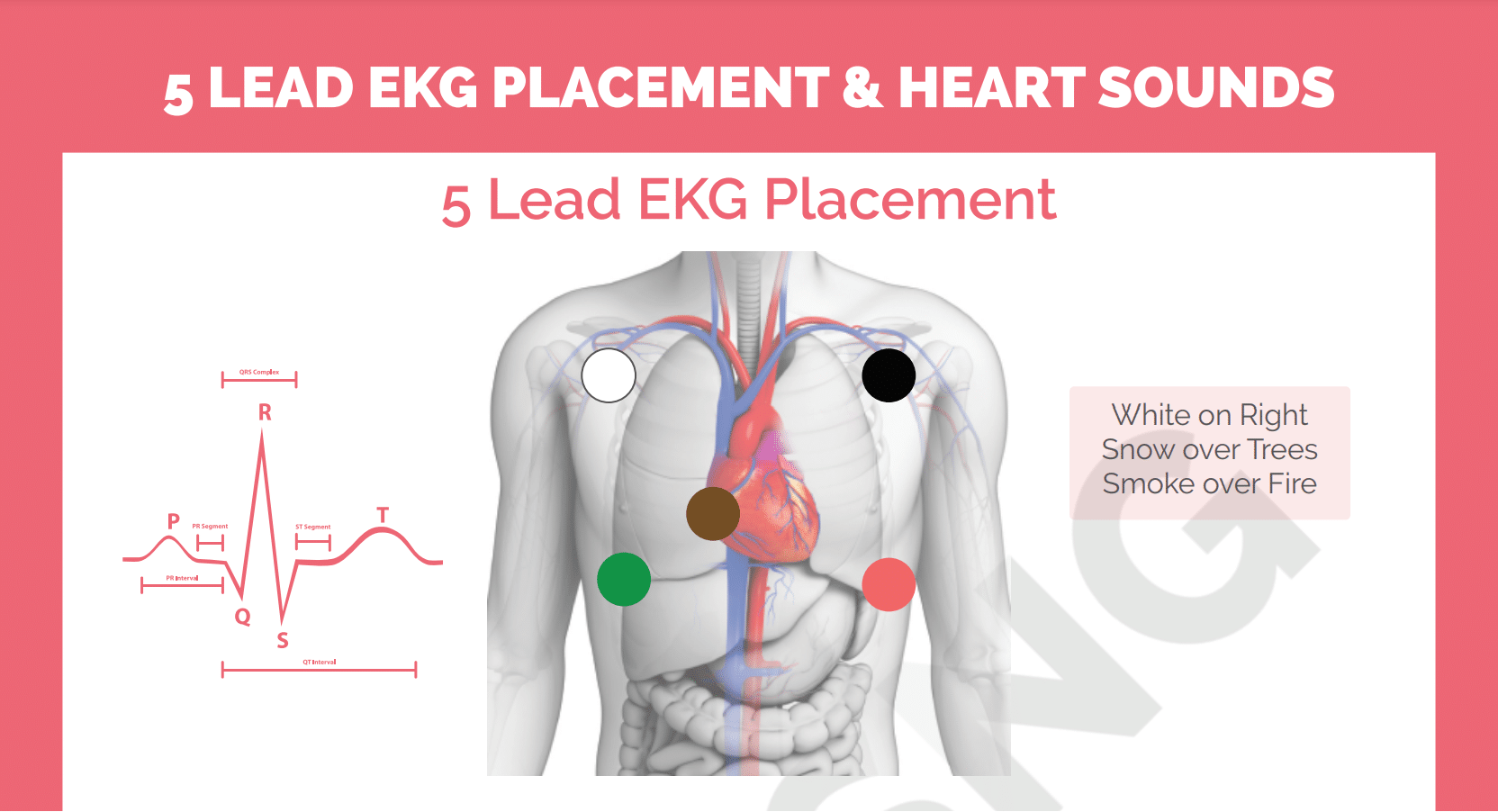 5 Lead EKG Placement