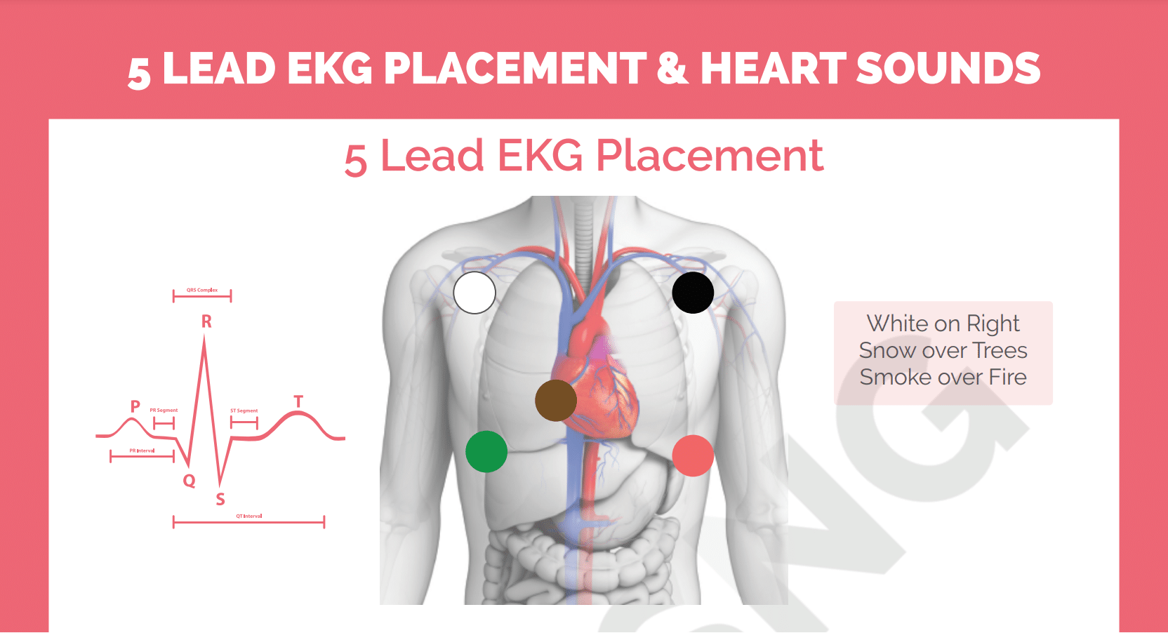 5 Lead Ekg Placement